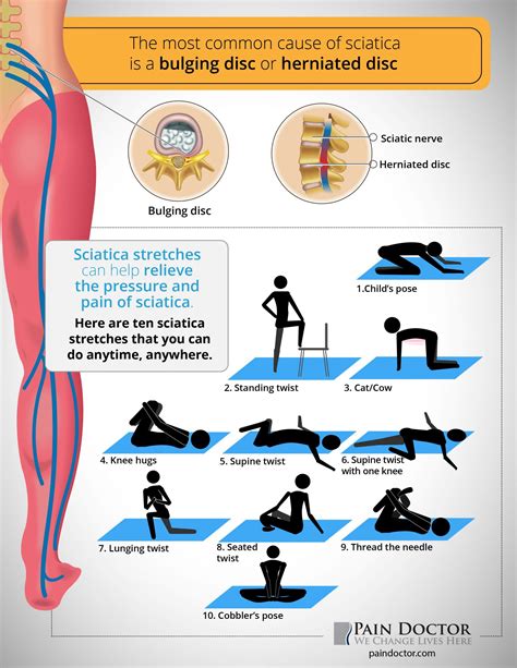 8 Exercises You Can Do At Home To Relieve Sciatic Nerve Pain Latest