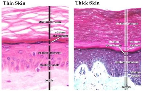 Thin Skin Versus Thick Skin Histology C03