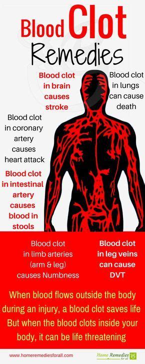 7 Home Remedies For Blood Clots Inside Your Body Better You Blood