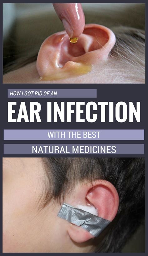 How I Got Rid Of An Ear Infection With The Best Natural Medicines