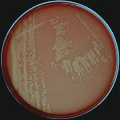 Listeria monocytogenes is the bacterium that causes the infection listeriosis. Listeria monocytogenes
