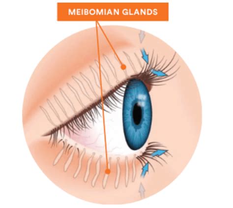 Meibomian Glands V Brenart Eye Clinic