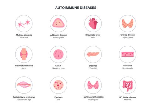 2000 Autoimmune Disease Stock Illustrations Royalty Free Vector