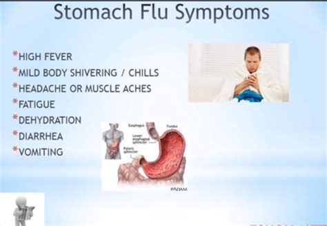 Is It A Stomach Flu Or Influenza Ring A Doctor Blog