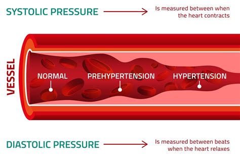 فشار خون Blood Pressure