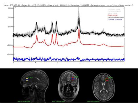 Clinical Features JMRUI