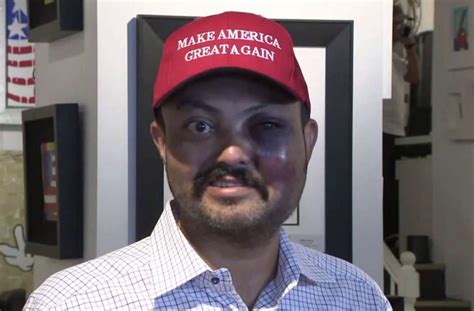 Man Claims He Was Assaulted In Nyc For Wearing Trump Maga Hat