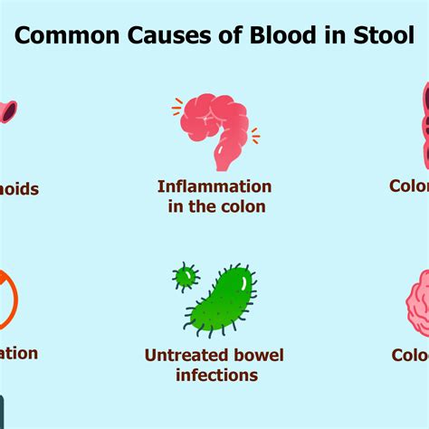 Reasons For Bright Red Blood In Stool Exurt