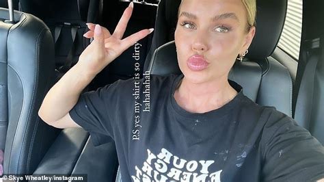 Skye Wheatley Shows Off Her Wrinkle Free Neck After Getting 1700 Injectable Anti Ageing Treatment