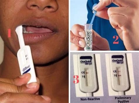 Uganda To Introduce Oral Hiv Self Test Kit Cgtn