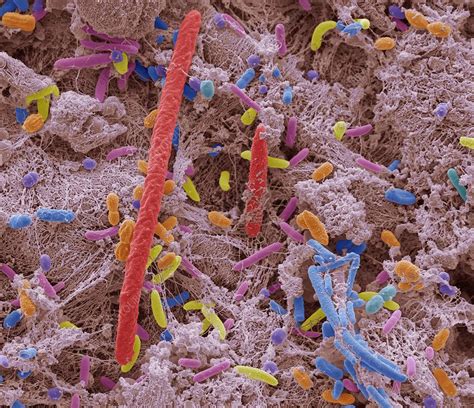 Oral Bacteria Sem Stock Image F0169471 Science Photo Library