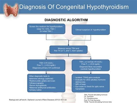 Neonatal Hypothyroidism Pictures