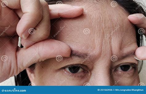 The Flabby Sagging And Forehead Lines On The Face Stock Photo Image