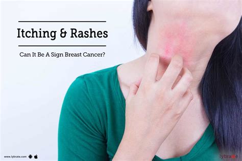Itching And Rashes Can It Be A Sign Breast Cancer By Dr Gajanan