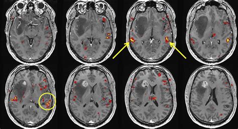 Functional Brain Anatomy Radiology Key