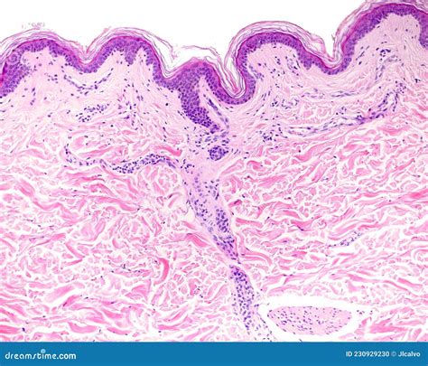 Thin Skin Stock Photo Image Of Histological Tissue 230929230