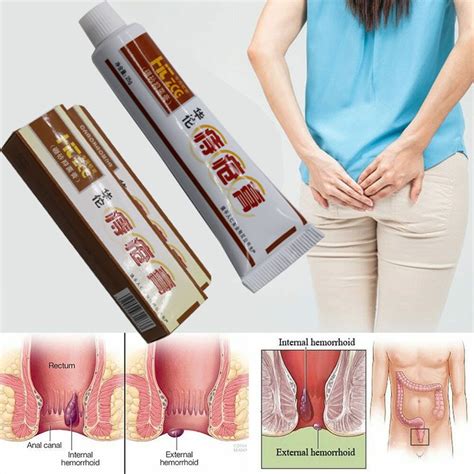 1box hua tuo hemorrhoids ointment herbal materials suppository powerful hemorrhoids cream