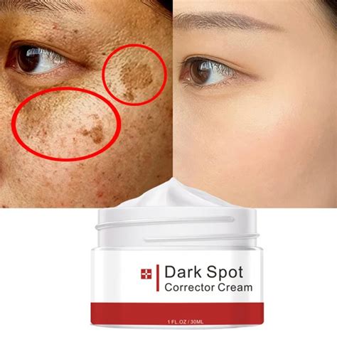 Brown Spots Freckles Repair Damaged Skin Black Spot Correction Creams