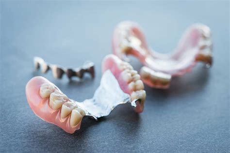 Important Facts About Denture Replacement You Must Know