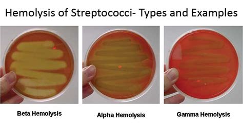 Hemolysis Of Streptococci Types And Examples Streptococcus