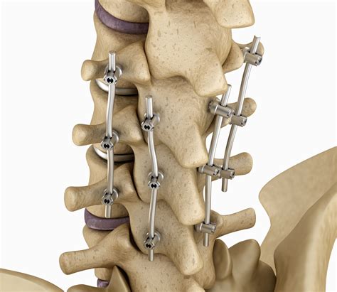 Axis Spine And Orthopedics