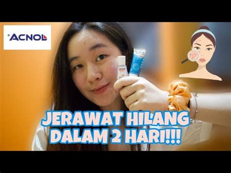 It is compatible with all android devices (required android 4.0+) and can also be able to. CARA MENGHILANGKAN JERAWAT DALAM 1 HARI?! PRODUK LOKAL ...