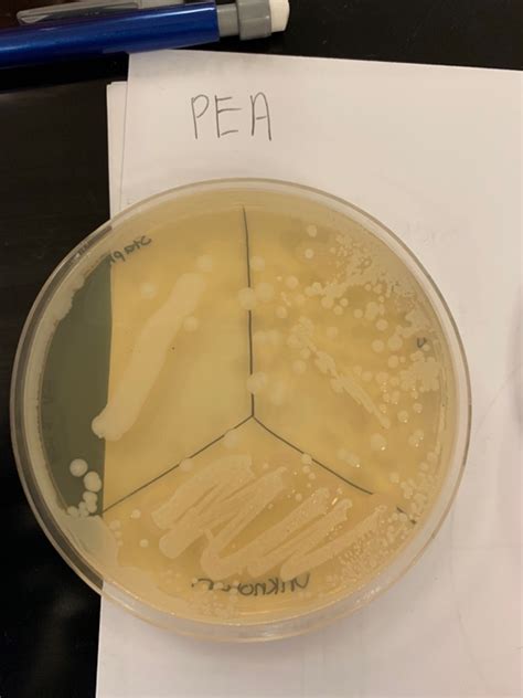 Solved Phenylethyl Alcohol Agar Pea Your Results And