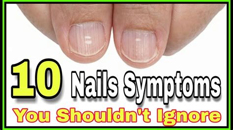 10 Nail Symptoms And What They Mean For Your Health You Shouldnt