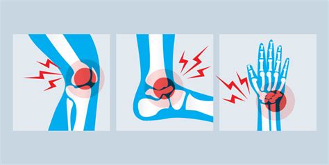 4 Common Sports Injuries Csp Global