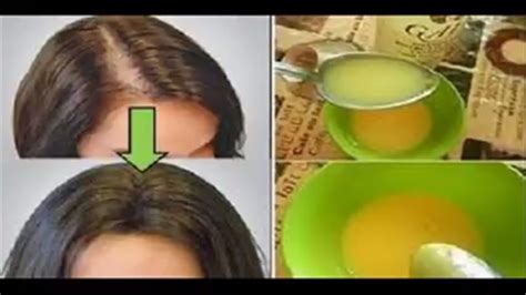 you can make your scalp grow hair back naturally just follow these simple steps youtube