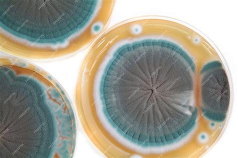 Premium Photo Penicillium Fungi On Agar Plate