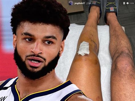 Nba S Jamal Murray Shows Off Battle Scar After Acl Surgery Brand New