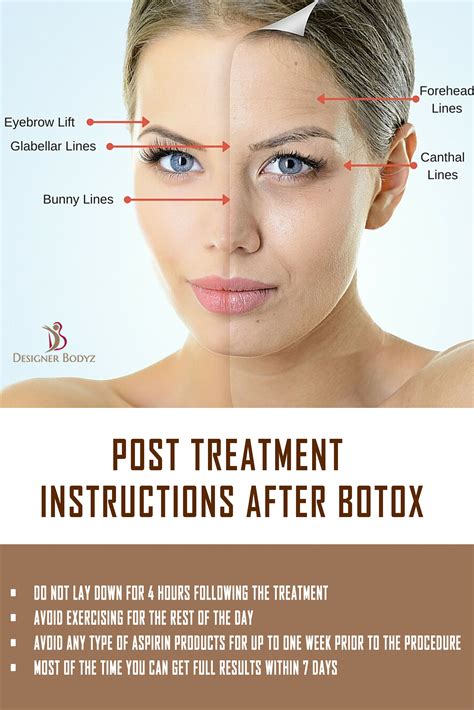Pin On Botox