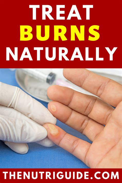 Arnica For Burnsget Homeopathic Relief Creams And Gels Treat Burns