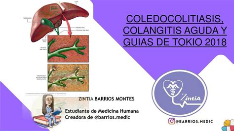 Coledocolitiasis Colangitis Aguda y Guías de Tokio 2018 BARRIOS MEDIC
