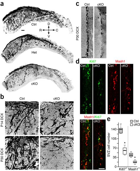 Ank3 Deletion In Chat Neurons Results In Postnatal Svz Neurogenesis