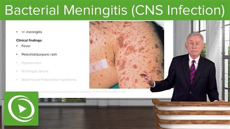 Bacterial Meningitis Cns Infection Infectious Diseases Lecturio