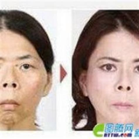 Saksikan bagaimana rupa artis korea selepas dan sebelum pembedahan kosmetik. Gambar Wajah Selepas Pembedahan Plastik