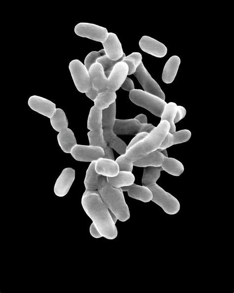 Gardnerella Vaginalis Photograph By Dennis Kunkel Microscopyscience