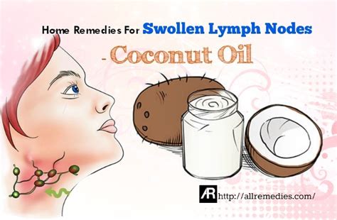 42 Home Remedies For Swollen Lymph Nodes Causes Symptoms Tips