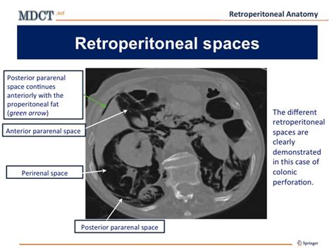 Retroperitoneal Anatomy Mdct Net