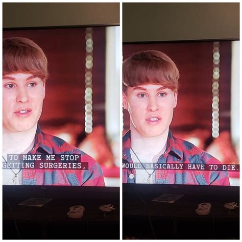 The Guy Who Spent Over 100k To Look Like Justin Bieber To Make Me