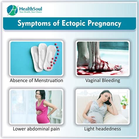 Ectopic Pregnancy Symptoms Diagnosis And Treatment Obstetric