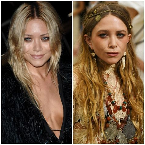 Did Mary Kate Olsen Get Plastic Surgery See Before And After Pics