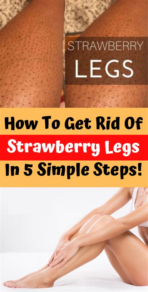 How To Get Rid Of Strawberry Legs Natural Health Remedies