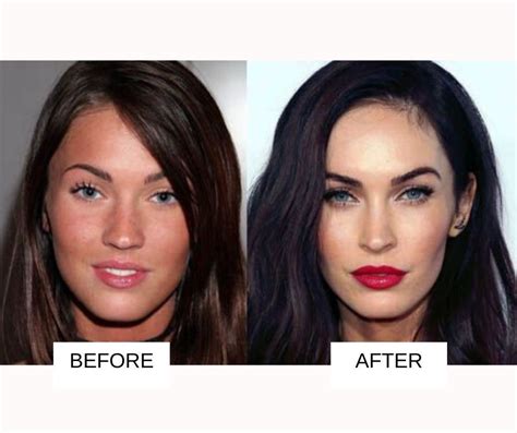 Celebrity Plastic Surgery Before And After Images Fabbon 23352 Hot Sex Picture