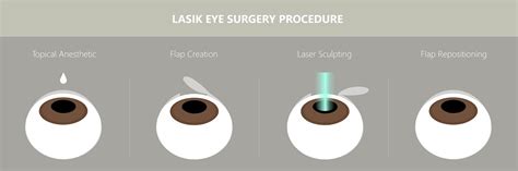 How Successful Is Lasik For Farsightedness