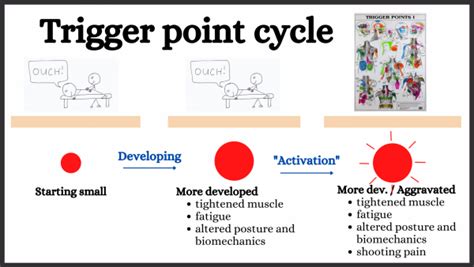 Trigger Point Release Explained Trigger Point Release Explained