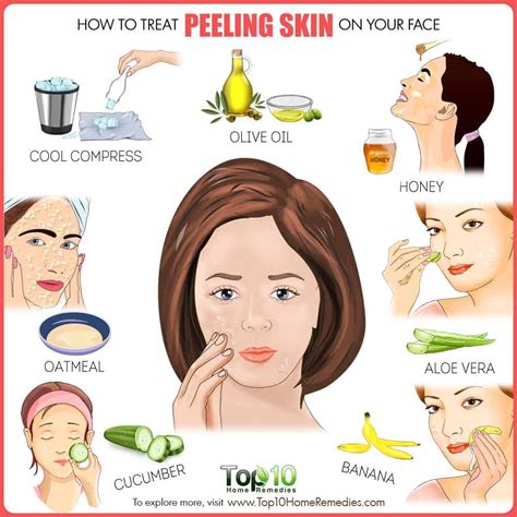 How To Treat Peeling Skin On Face Top 10 Home Remedies