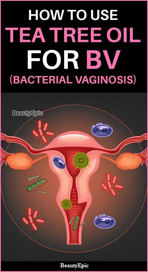 How To Cure Bacterial Vaginosis Bv With Tea Tree Oil Diy Herbal